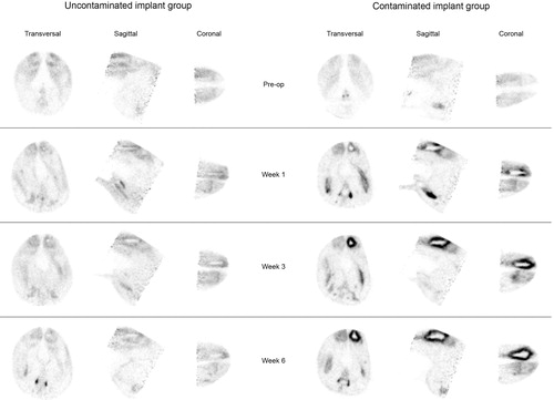 Figure 3. Representative images of 18F-FDG uptake in the uncontaminated implant group (left) and the contaminated implant group (right) during the 6-week follow-up.