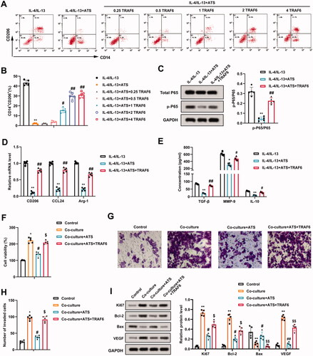 Figure 5. Impact of TRAF6 on the inhibitory effect of asiaticoside on the growth and invasion of osteosarcoma cells induced by M2 phenotype macrophages. IL-4/IL-13-induced M2 phenotype macrophages were treated with 40 μM ATS and TRAF6 (0.25, 0.5, 1.0, 2.0, and 4.0 μg/mL). (A and B) The positive rate of M2 phenotype macrophages was assessed using flow cytometry. (C) The total P65 and p-P65 protein levels were determined by Western blot. (D) Detection of the CD206, CCL24, and Arg-1 expressions using qRT-PCR. (E) The TGF-β, MMP-9, and IL-10 contents were measured by ELISA. (F) M2 phenotype macrophages induced by IL-4/IL-13 were co-cultured with osteosarcoma cells, and the cells were treated with 40 μM ATS and 2 μg/mL TRAF6. Comparison of the U2OS cell viability using CCK-8 assay. (G and H) The invasion of U2OS cells was assessed by Transwell and the quantitative results of cell invasion (magnification: 200). (I) Comparison of the Ki-67, Bcl-2, Bax, and VEGF protein levels using Western blot. **p < 0.01 vs. IL-4/IL-13. *p < 0.05, **p < 0.01 vs. control. #p < 0.05, ##p < 0.01 vs. IL-4/IL-13 + ATS or co-culture. $p < 0.05, $$p < 0.01 vs. co-culture + ATS. Each assay was conducted in triplicate. NC, negative control.