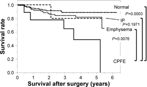Figure 2 Disease-specific survival in the four groups: Kaplan–Meier curves for disease-specific survival.