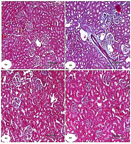 Figure 3. Photomicrographs of kidney section of rats showing (a): Control group with minimal amount of collagen fibers. (b): Group CCl4 showing marked increase of collagen fibers in the interstitium around the renal tubules, Bowman’s capsule and blood vessels. (c): CCl4 + rats BM-MSC and (d): CCl4 + mice BM-MSCs, respectively, showing scantly collagen fibers compared with group CCl4. (Masson’s trichrome stain; Scale bar of a–d = 100 µm).