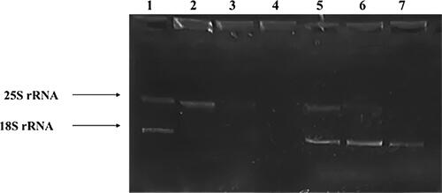 Figure 3. Total RNA isolated from untreated and treated G0 (168 h) and proliferating (24 h) S. cerevisiae BY4741 cells. Approximately 0.3 µg of total RNA was loaded in each well. Samples: Lane 1: untreated G0 cells; 2: G0 cells + H2O2; 3. G0 cells + menadione; 4. unloaded well; 5. untreated Log cells; 6. Log cells + H2O2; 7. Log cells + menadione.