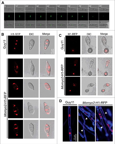 Figure 10. Localization of Momyo2 and nuclear distribution in Momyo2 mutants. (A) Momyo2-eGFP dynamics during septation processes in hyphae. Mycelia of the Momyo2-eGFP strain were overnight cultured, and then Momyo2-eGFP dynamics during septation were visualized by a confocal fluorescence microscope. (B, C) Nuclear distribution in Momyo2 mutants. Nuclear signal in conidia and appressorium of both Guy11 and Momyo2 mutants were visualized by a confocal fluorescence microscope. (D) Nuclear distribution in the hyphae of Momyo2 mutants. Both Guy11 and Momyo2 mutants expressing H1-RFP fusion protein were overnight cultured in liquid CM, stained with CFW and then visualized by a confocal fluorescence microscope. Arrows indicated the hyphae without cytoplasm.