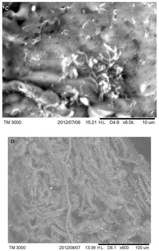 Figure 5 (A) Scanning electron microscopy (SEM), demonstrating typical appearance of filament projecting from skin surface, patient 2. Scale bar is shown at bottom of SEM. (B) SEM demonstrating the typical helical-shape outline of a spirochete under the skin surface, one-third down from top of right side (arrow). Scale bar is shown at bottom of SEM. (C) SEM of same specimen also demonstrating bacterial forms consistent with morphological variations of Borrelia spp. Scale bar is shown at bottom of SEM. (D) SEM of bovine digital dermatitis filaments, demonstrating filamentous and scaling surfaces. Scale bar is shown at bottom of SEM.