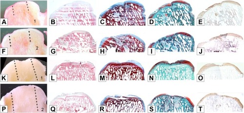 Figure 4 Treated group: macro and histological observations of 2 condyles, sectioned in half (number 1 in images A and K: right hemicondyle; number 2 in images F and P: left hemicondyle).