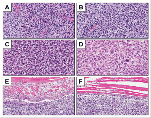 Figure 4. Tumor histology. H & E-stained sections of the original patient tumor (A); subcutaneously-implanted tumor (B); orthotopically-implanted tumor (C); and recurrence of orthotopically-implanted tumor after marginal excision (D); H & E-stained sections of tumor muscle margin of the orthotopically-implanted tumor (E, F).