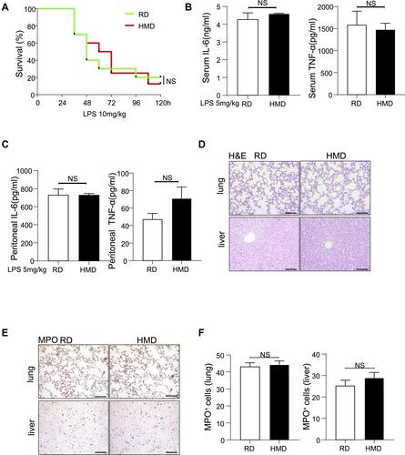 Figure 2 Methyl diet does not significantly increase mortality and inflammation in the LPS-induced septic model. (A) Survival curve of two groups of mice after receiving LPS-induced sepsis modeling (n=10/group). (B, C) The levels of IL-6 and TNF-α (B) in serum and peritoneal lavage fluid (C) were detected 24h after LPS treatment (5mg/kg) in two groups of mice (n=4/group). (D, E) Representative lung and liver images of H&E and MPO staining of LPS-treated (5mg/kg) two groups of mice (200×). (F) The statistical quantification of MPO staining. The data are shown as means ± SEM.