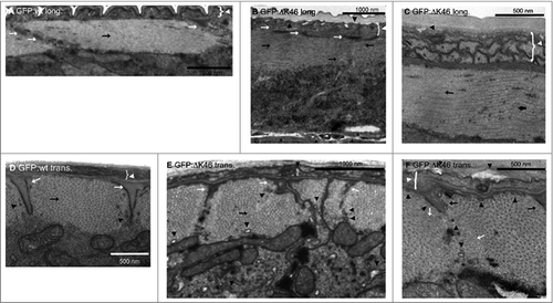 Figure 2. Transmission electron microscopy images reveals muscle abnormalities in animals expressing GFP:ΔK46. Longitudinal (long) (A) and transverse (trans) sections of wildtype animals or animals expressing GFP:ΔK46. Data is taken from Fig, 8 in [Citation43].