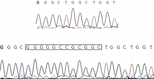 Figure 2. Sequencing of 12-bp deletion (above) and insertion (down) polymorphisms (the insertion sequence is showed in box).