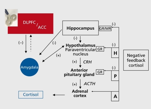 Figure2. Visualization of a theoretical working mechanism of HF-rTMS applied to the DLPFC on the HPA-system in unipolar major depression. In the left hand corner a figure-of-eight shaped repetitive transcranial magnetic stimulation (rTMS) coil is depicted. rTMS treatment results in increased neuronal activity in the (dorsolateral) prefrontal cortex, which through cortico-subcortical trans-synaptic connections (presumably through frontocingulate networks)Citation32 suppresses hypothalamic and/or indirectly amygdala overactivity, resulting in CRH decreases and ultimately in decreased salivary cortisol concentrations. In line with successful pharmacological interventions, successful rTMS treatment results in normalization of the negative feedback system.Citation46 The areas in red represent an elevated neuronal activity. The blue areas represent the reverse, a diminished level of neuronal activity. ACTH, adenocorticotropic hormone DLPFC, dorsolateral prefrontal cortex; ACC, anterior cingulate cortex; GR, glucocorticoid receptors; MR, mineral-corticoid receptor; CRH, corticotrophin-releasing hormone; ACTH: adenocorticotrope hormone; H, Hypothalamus; P, Pituitary gland; A, Adrenal cortex; (-), inhibitory; (+) ,excitatory