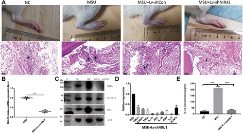 Figure 2 NINJ1 knockdown inhibits rat gout flare. (A) Images of rat joint swelling and redness, and hematoxylin and eosin staining of rat joint inflammation. Asterisks indicate the infiltrating leukocytes. (B) RT-PCR of NINJ1 expression in rat joints. (C) Western blot of NLRP3, pro-IL-1β, and NINJ1 expression in PBMCs of different groups. (D) Compare of individual inflammatory genes expression between MUS treated WT and NINJ1 knockdown animals in PBMCs. (E) Serum mature IL-1β level quantified by ELISA. ***P<0.001, and ****P<0.0001. Three rats were included in each group, and the experiment was repeated for four times. (M) standard protein ladder.
