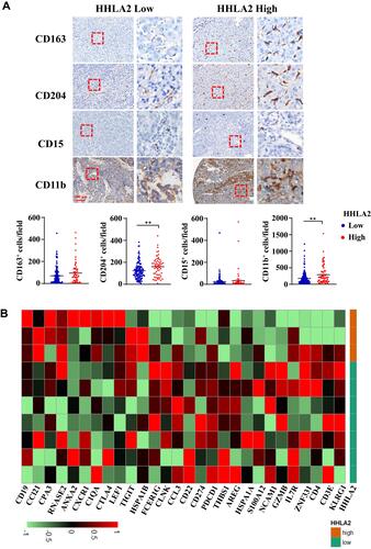 Figure 4 HHLA2 expression indicated an immune inhibitory microenvironment in the tumor nest of HCC. (A) Representative images of CD163, CD 204, CD15, and CD11b by IHC staining in HCC tissue, and the correlation between HHLA2 expression in the peri-tumor region and myeloid cell infiltration in the tumor nest of HCC (scale bar: 100 μm). **P < 0.01. (B) A heatmap shows the relationship between the expression of immune-related genes and HHLA2 in the peri-tumor region of HCC. Gene expression was normalized, and lima package was employed to acquire the differential gene expression.