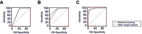Figure 2 Receiver operating characteristic curves. (A) Lesions were assigned to negative (category 3) or positive (category 4 and 5) in each group. The AUC for real-time and static image group was 0.786 vs 0.780, respectively. (B) Lesions were assigned to 3, 4 or 5 categories in each group. The AUC for real-time and static image group was 0.915 vs 0.855, respectively. (C) Lesions were assigned to 3, 4A–4C or 5 subcategories/categories in each group. The AUC for real-time and static image group was 0.969 vs 0.955, respectively.Abbreviation: AUC, Area under the ROC curve.
