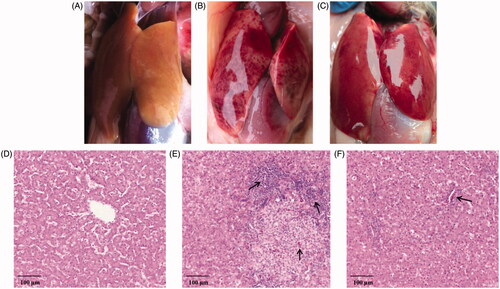 Figure 2. The pathological change of the liver in each group. A, visual pathological changes of blank control; B, visual pathological changes of virus control; C,visual pathological changes of BLIN treating; D, H&E staining (200×) of blank control; E, H&E staining (200×) of virus control; F, H&E staining (200×) of BLIN treating.