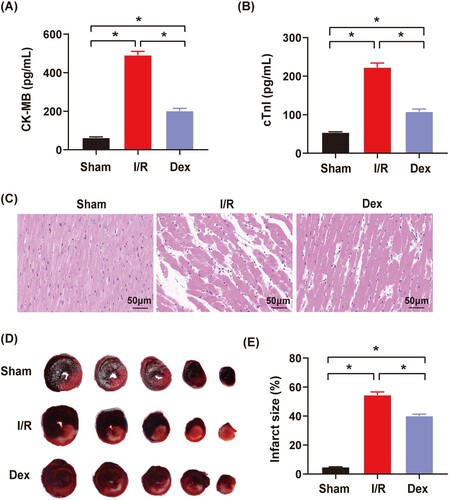 Figure 2. The effects of Dex postconditioning on myocardial enzymes, pathological changes of myocardial damages and infarct sizes in the rats with myocardial IRI. (A) and (B) Serum CK-MB and cTnI levels (n = 5); (C) Pathological changes of myocardial damages with HE staining (n = 3), magnification: ×200, bar = 50 μm; (D) and (E) Infarct sizes determined by the Evans blue and TTC staining (n = 6). Date was expressed as the mean ± SEM. *P < .05.