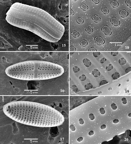 Figs 15 – 20. Scanning electron micrographs of Achnanthes cf. subsessilis, clone C. Fig. 15. Girdle view, showing porous girdle bands. Fig. 16. Raphid valve, internal view. Fig. 17. Araphid valve, internal view, with eccentric pseudoraphe. Figs 18 – 20. Cribrate areolae. Fig. 18. External surface of valve. Fig. 19. Internal surface of valve. Fig. 20. Internal surface of girdle band. Scale bars as labelled (for Figs 19 and 20, see Fig. 18).