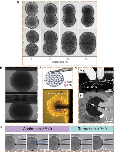 Figure 4. Probing spheroids from without. a) Spheroid fusion time series demonstrating cell type dependence. Spheroids formed from the non-tumourigenic MCF-10A cell line (top) fuse slower than spheroids made from metastatic MDA-MB-231 cells (bottom). Scale bar: 100 µm. b) Tissue surface tensiometry with an uncompressed (top) and compressed (bottom) spheroid in culture medium. c) Schematic and image of a spheroid in contact with a tip-less AFM cantilever. d) (A) Microtweezer set-up and (B) cantilever tips compressing a spheroid. e) Time series of the micropipette aspiration of a spheroid for almost 3 hours, and retraction of the tongue as the aspiration pressure is set back to zero. (a) is reprinted and adapted from [Citation76], licensed under CC BY 4.0; (b) is reprinted and adapted from [Citation176], licensed under CC BY 3.0; (c) is reprinted and adapted from [Citation90], Copyright 2021, with permission from Elsevier; (d) is reprinted and adapted from [Citation92], licensed under CC BY 4.0; (e) is reprinted and adapted from [Citation178], Copyright 2017, with permission from Elsevier