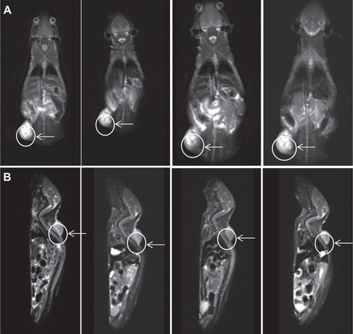 Figure 8 MR imaging.Notes: A series of pictures showed T2-weighted MR images acquired at the defined time points on the 11.7 T system, where (A) 800ZW–SPION@dSiO2–YY146 appeared as discrete, punctuated, negative contrast regions. A significant decrease in image contrast occurred between the time points 24 and 48 hours followed by a gradual decrease thereafter; (B) 800ZW–SPION@dSiO2, as the image arrows were shown, it was difficult to find the change among prescanning and three time points. Tumors are indicated by white arrows.Abbreviations: MR, magnetic resonance; SPION, superparamagnetic iron oxide nanoparticles.