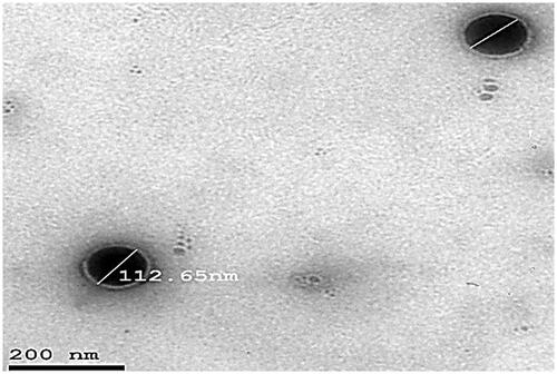 Figure 5. TEM image of the optimized DOM-loaded ethosomes (F3).