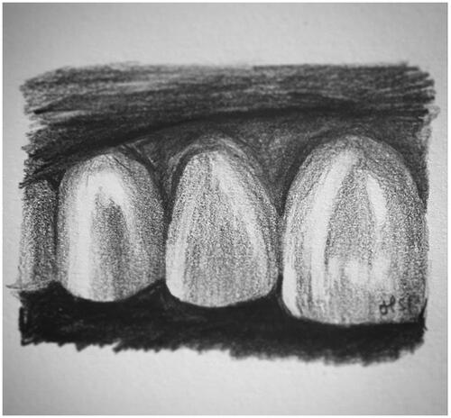 Figure 5. Drawing incisors.
