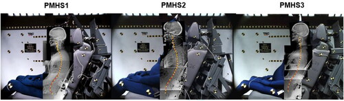 Figure 4. Spinal curvatures determined from PMHS X-ray images.