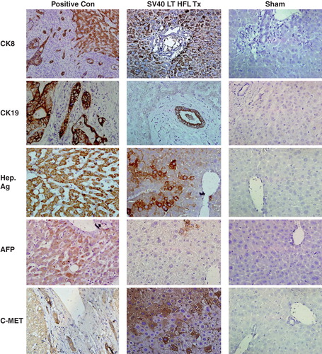 Figure 5. Expression of human liver-specific markers in the livers of nude mice transplanted with SV40 LT hFLCs. Two million SV40 LT HFL were transplanted into the spleen of D-galactosamine treated nude mice that underwent 30% partial hepatectomy at the time of transplantation. Immunohistochemistry was performed on fresh frozen liver sections of transplanted animals, and small clusters of human CK8-, CK19-, hepatocyte specific antigen-, and c-Met-expressing, engrafted cells (dark red-brown) with hepatocyte morphology were detected throughout the liver. Some cells expressing alphafeto protein were also detected. Biopsy sections from patients with liver cancer served as positive control and staining of liver sections from sham transplanted animals served as negative control. HE was used as counter-stain. (Magnification 40×.) CK, cytokeratin; Hep Ag, hepatocyte-specific antigen; AFP, alphafeto protein.