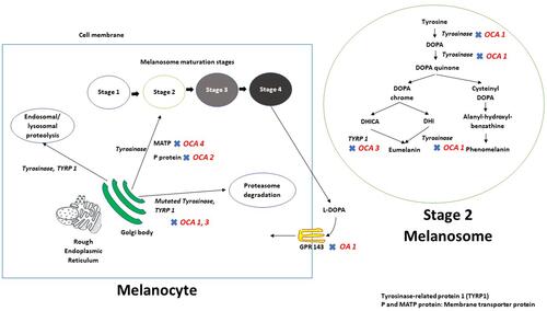Figure 1 Schematic representation of melanin biosynthesis in the melanocyte. After synthesis and subsequent processing in the Golgi body - rough endoplasmic reticulum (ER) complex, tyrosinase and tyrosinase-related protein 1 (TYRP1) are trafficked to the developing melanosome via membrane transporter proteins P and MATP. Mutations in tyrosinase or in TYRP1 result in the retention of these mutant proteins in the ER, and these are subsequently degraded using proteasome mediated pathways. The rest of the tyrosinase and TYRP 1 proteins undergo endosomal/lysosomal proteolysis. Retinal pigment epithelium makes and releases L-DOPA during the procerss of melanin biosynthesis; L-DOPA is an endo agonist for GPR 143 (expressed at the membrane of the melanosomes) thus create an autocrine loop. GPR143 is the protein product of OA1 and mutations at this locus result in ocular albinism type 1.