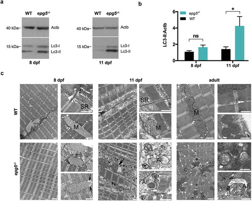 Figure 3. Autophagy impairment in zebrafish epg5-/- mutants. (a) Representative western blot for Lc3 in WT and epg5-/- larvae at 8 dpf and 11 dpf, and (b) densitometric analysis of band intensities. Actb/β-actin was used as a control for protein loading. Statistical significance was determined by one tail Student’s t-test. Data are presented as mean ± SEM and were generated from 4 biological replicates with pools of 10 larvae (*, P < 0.05; n.s., not significant). (c) Transmission electron microscopy analysis of skeletal muscle of WT and epg5-/- larvae and adults. WT larvae and adults (upper panels) display well-organized myofibrils with subsarcolemmal mitochondria (M) and a well-developed sarcoplasmic reticulum (SR). 8-dpf epg5-/- larvae do not display overt changes of the ultrastructural organization of muscle fibers with respect to WT larvae, except for some subsarcolemmal membrane-like structures (ml), and some mitochondria with dilation of the outer membrane (arrows). Changes suggestive of altered autophagic flux, as accumulation of autophagosomes (AF), are evident in 11-dpf epg5-/- larvae. Although at a lesser extent, autophagosomes are also present in adult epg5-/- zebrafish. Ultrastructural analysis was performed on 4–5 animals for each condition. Scale bar: 1 µm.