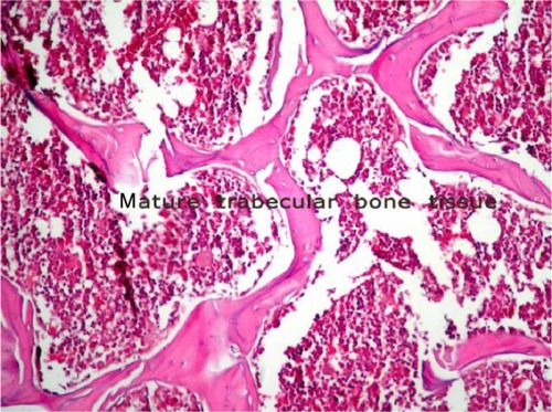 Figure 5 Histopathological sample of bone tissue. The sample is mostly mature bone tissue.