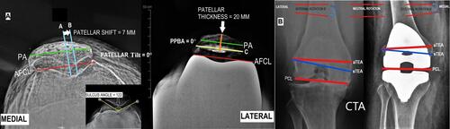 Figure 4 Assessment in the axial plane (special views).