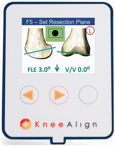 Figure 1. The KneeAlign 2™ display console (2 × 4 × 2 inches in size).