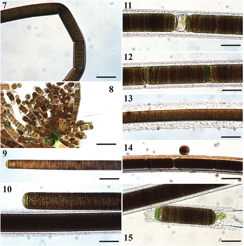 Figs 7–15. Microscope images of Sirenicapillaria rigida (reference strain BLCC-M116).