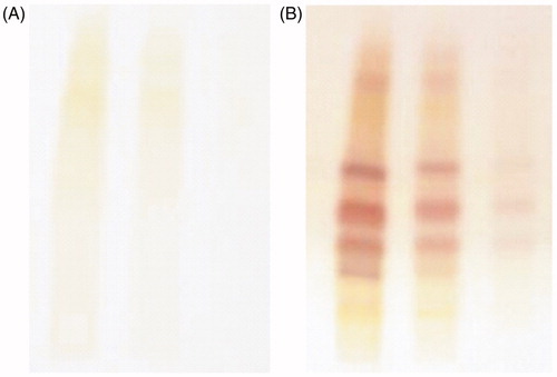 Figure 1. High performance thin layer chromatography (HPTLC) plates: (A) before derivatization, (B) after derivatization.