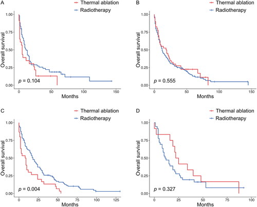 Figure 4. Kaplan–Meier survival curves for OS between the thermal ablation and radiotherapy groups when age was <65 years (A), 65–74 years (B), 75–84 years (C), or ≥85 years (D) after PSM. OS: overall survival; PSM: propensity score matching.
