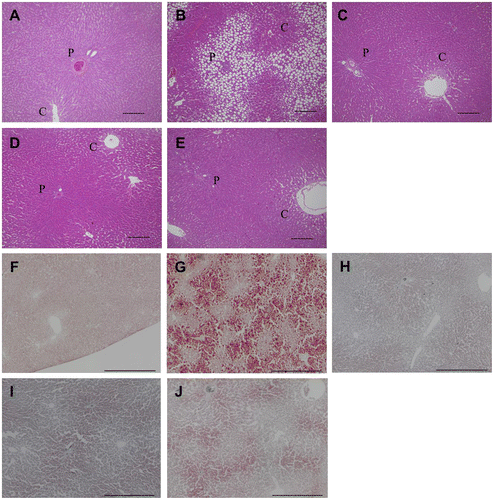 Fig. 1. Histologic changes in liver lobules by FCE and its fat/protein fractions in rats fed chloretone for 14 days.Notes: All images are light micrograph liver sections and show rats fed a (A), (F) basal diet; (B), (G) diet that contained chloretone; (C), (H) diet that contained chloretone supplemented with total FCE; (D), (I) diet that contained chloretone supplemented with the fat fraction of FCE; (E), (J) diet that contained chloretone supplemented with the protein fraction of FCE. In figure (A)–(E), sections were stained with H & E, and scale bar indicate 100 μm. P, portal vein; C, central vein. In figure (F)–(J), sections were stained with Oil Red-O, and scale bar indicate 500 μm.