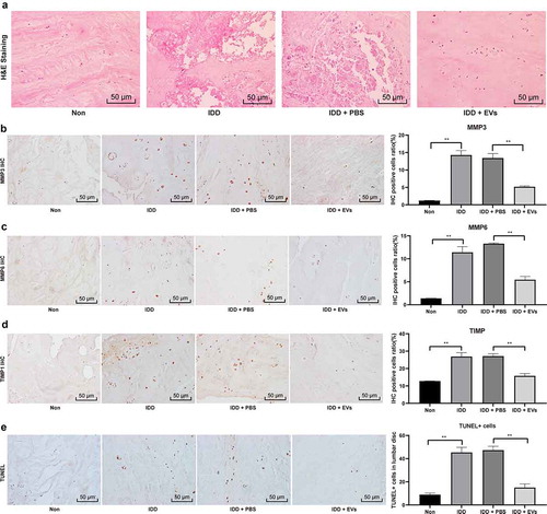 Figure 2. BMSCs-EVs promote the repair of IDD in mice. (a), HE staining was performed to represent for intervertebral disc pathology observation (× 200);(b–d), immunohistochemical staining to evaluate the positive expression of MMP-2 (b), MMP-6 (c) and TIMP1 (d) in the nucleus pulposus of the intervertebral disc of mice in each group; E, TUNEL staining were performed to measure apoptosis index of the intervertebral disc (× 200). Three independent experiments were performed, and each group contained at least 8 mice. Data are expressed as mean ± s.d. One-way ANOVA and Tukey’s multiple comparisons test were used to determine statistical significance. **p < 0.01