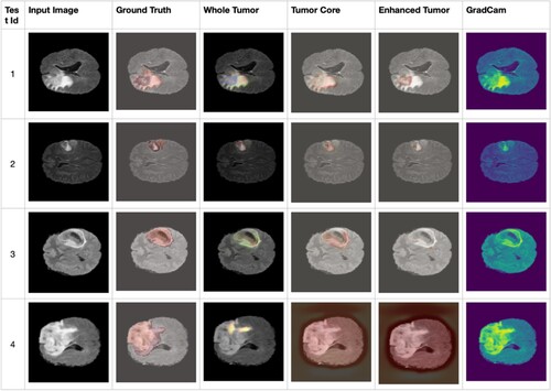 Figure 9. Visualization of Input Image, Ground Truth, Whole tumour, Tumor core, Enhanced Tumor, and Grad-CAM highlighted.