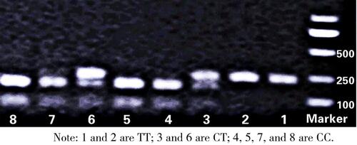 Figure 1 Electrophoresis of the restriction enzyme cleaved product of C3435T.