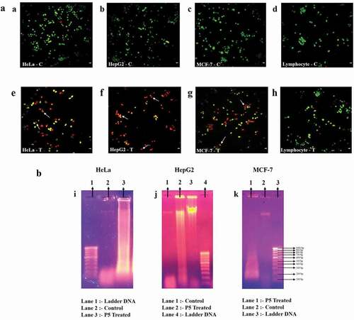 Figure 2. (a). Fluorescence microscopic photographs after AO/EtBr staining. Arrows indicate apoptotic bodies/chromatin condensation. C – control and T – P5 treated; Scale bar: 20 μm. (b): DNA fragmentation analysis of HeLa, HepG2 and MCF-7 cells
