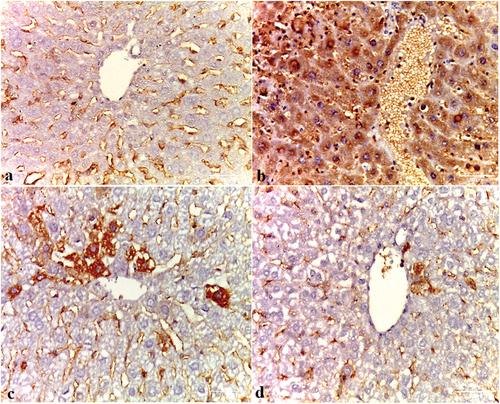 Figure 13. Photomicrographs showing VEGF immuno-expression in (a) negative control, (b) HCC control group, (c) HCC+IQ 10 mg/kg bw -treated group and (d) HCC+IQ [20 mg/kg bw]-treated group. Negative control showing localized and weak VEGF immunoreactivity along the sinusoids and portal vessels, while in HCC control group VEGF is diffuse in strong positive immunoreactivity along with hepatocytic cytoplasm, endothelial cells, sinusoids, and portal vein. HCC+IQ [10 mg/kg bw] -treated group showing localized VEGF immunoreactivity along the sinusoids and there are some sporadic cells still have the stain, while in HCC+IQ [20 mg/kg bw]-treated group there is weak localized VEGF immunoreactivity along the sinusoids and portal vessels.