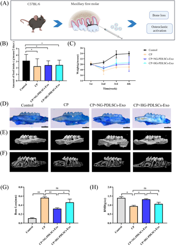 Figure 4 The effect of NG-PDLSCs-Exo and HG-PDLSCs-Exo on periodontal regeneration. (A) Schematic representation of the periodontitis model of the maxillary first molars in C57BL/6 mice. (B) Food intake statistics of mice. (C) Weight statistics of mice. (D)The structure of mice maxilla stained with methylene blue. Scale bar: 1 mm. (E and F) Representative micro-CT images showing alveolar bone resorption in the control, CP, CP+NG-PDLSCs-Exo and CP+HG-PDLSCs-Exo groups. (G)The degree of alveolar bone loss was determined by measuring the average CEJ-ABC distance at the six sites on the first molar. (H) The degree of alveolar bone loss was determined by measuring bone mineral density in the distal alveolar bone of the maxillary first molar using CTan software. Data are shown as the mean ± SD of three independent experiments. Statistical analyses were performed by ANOVA. *P<0.05, **P<0.01, ns indicates no statistical significance.