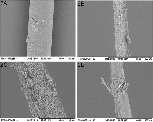 Figure 2 Images of fungi eroding hair under the scanning electron microscope. Appearance of normal hair (A) appearance of a hair that has just been eroded by fungus (B); two severely eroded hair features obtained at the centre of the lesion (C and D).