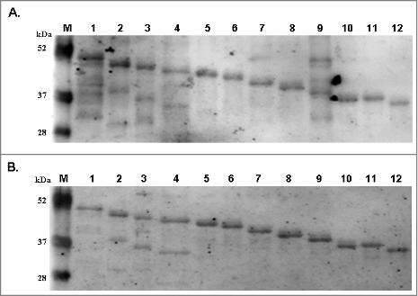 Figure 2. Reactivity of antibodies against cardiolipin and β2GPI to truncated B19-VP1u (B19-tVP1u) proteins. Full-length B19-VP1u and B19-tVP1u proteins were probed with antibodies against (A) cardiolipin and (B) β2GPI. Lane M indicates pre-stained protein marker; lane 1 indicates the full-length B19-VP1u, and lanes 2 to 12 correspond to the truncated deletions 2 to 12, respectively.
