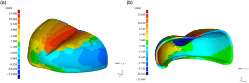 Figure 8. Three–dimensional analysis of toecap deformation after the fourth impact: (a) outer side; (b) inner side.Note: The full color version of this figure is available online.