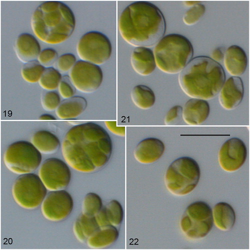 Figs. 19–22 Morphology and phenotypic plasticity of Chloroidium saccharophilum (19–20) and C. ellipsoideum (21–22) under freshwater (19, 21), and marine conditions (20, 22). 19–20. CCAP 211/27; 21–22. CCAP 211/76; scale bar = 10 µm.