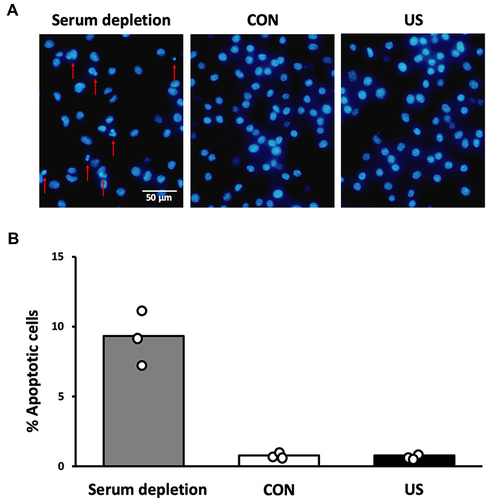 Figure 3 Morphological observation of apoptosis. (A) Bone marrow-derived macrophages were stained with DAPI staining 24 h after ultrasound irradiation. Red arrows indicate chromatin condensation and fragmentation. (B) The percentage of apoptotic cells to total cells was calculated. Triplicate cell cultures were analyzed. Nuclei from 10 random fields of each dish were examined. Mean and individual data points are shown.