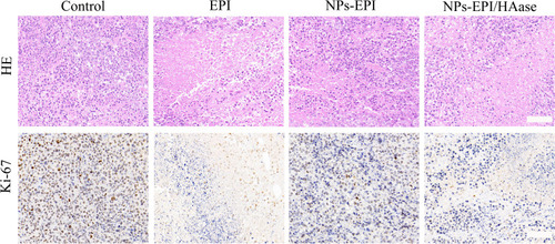 Figure 10 H&E and Ki-67 staining of the HepG2 tumor slices from mice treated with saline, EPI, NPs-EPI and NPs-EPI/HAase. Scale bar represents 100 μm.