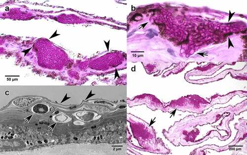 Figure 2. Wing membrane. Histologic periodic acid Schiff stain (a, b, d) and transmission electron micrographic (TEM, c) sections of wing membrane from Myotis lucifugus infected with Pseudogymnoascus destructans causing white-nose syndrome. Fungal hyphae are stained magenta. Lack of inflammatory cell reaction is consistent with WNS in hibernating bats [Citation5]. (a) Pigmented cells of the epidermal layer (arrowheads) illustrate the intraepidermal boundary above and below dense packets of irregular P. destructans hyphae without epidermal damage [Citation21]; this is consistent with the biotrophic stage of invasion. (b) Intraepidermal proliferation of fungal hyphae demarcated above and below by pigmented epidermis (arrowheads). Arrows show hyphae penetrating the basement membrane of the epidermis initiating infection of the deeper dermis. This hyphal invasion resembles the penetration mechanism used by some types of appressoria. (c) TEM shows fungal hyphae (arrows) within the outer layer (stratum corneum) of the epidermis. Arrowheads indicate the layer of bat epidermal cells covering hyphae without morphologic change or evidence of damage to the host cells; this is consistent with biotrophic infection. (d) Progression of P. destructans infection into deeper dermis (arrows) with replacement of connective tissue of the wing membrane with fungal hyphae.