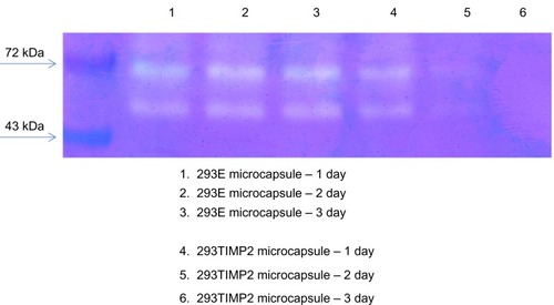 Figure 4 Gelatin zymography. U87MG cells were cultured in 10 cm dishes (cell density 70%–80% of dish area) with Dulbecco’s Modified Eagle’s Medium (DMEM) containing 10% fetal bovine serum. U87MG cells cultured with serum-free DMEM were treated with 293E or 293TIMP2 microcapsules (>100 microcapsules).Abbreviations: TIMP2, tissue inhibitor of metalloproteinase-2; 293TIMP2, 293T cells genetically modified to secrete tissue inhibitor of metalloproteinase-2.