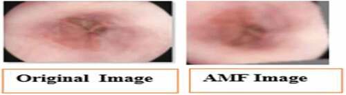 Figure 2. Original and resultant image after noise removal.