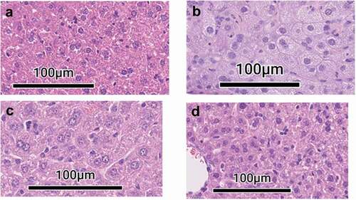 Figure 5. Pathology in livers of mice inoculated with S4ΔaroD vs WT Shu S4. C57BL/6 mice (n = 3 per group at each time point) were inoculated i.n. with 5.6 × 103 CFU Schu S4ΔaroD or 1.5 CFU WT Schu S4 and euthanized on days 1, 3, 7, 14 post-infection. Liver sections were, stained with H&E. (a) Liver section taken from mock-infected mouse. (b)Liver section taken from WT Schu S4-infected mouse on day 7. (c, d) Liver sections taken from Schu S4ΔaroD-infected mouse on days 7 (c), and 21 (d) days post infection